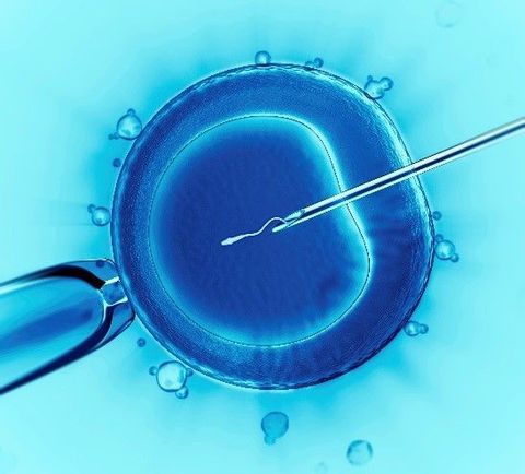 Complete IVF Knowledge Guide: Explore Treatment Stages, Risks, Benefits & Considerations