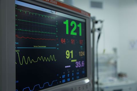 Heart Monitoring Equipment Guide: Explore ECG Machines, Electrodes & Signal Analysis