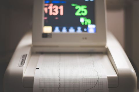 ECG Machine Guide: Explore Working Principles, Components, Features & Expert Insight