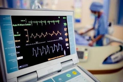 ECG Machine Guide: Explore How It Works, Types, Components, Electrodes & Clinical Applications